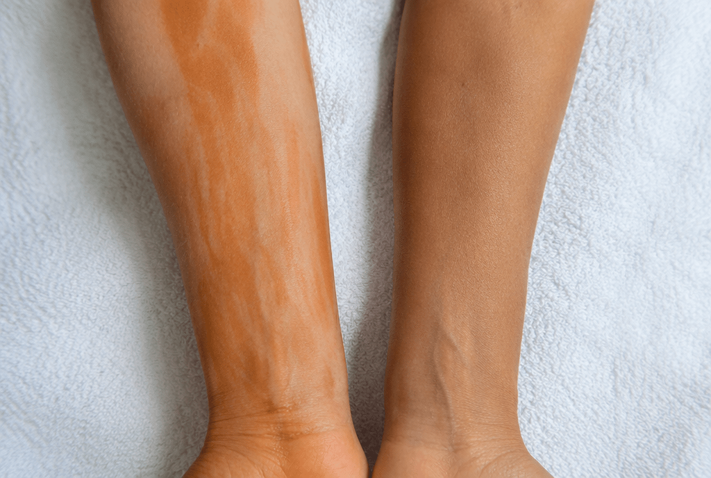 Will a Tan Accelerator Make Me Orange? The Truth About DHA and Bronzers - Delux Tanners